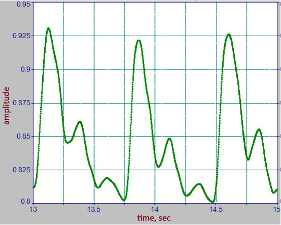 Example of typical volume pulse waves